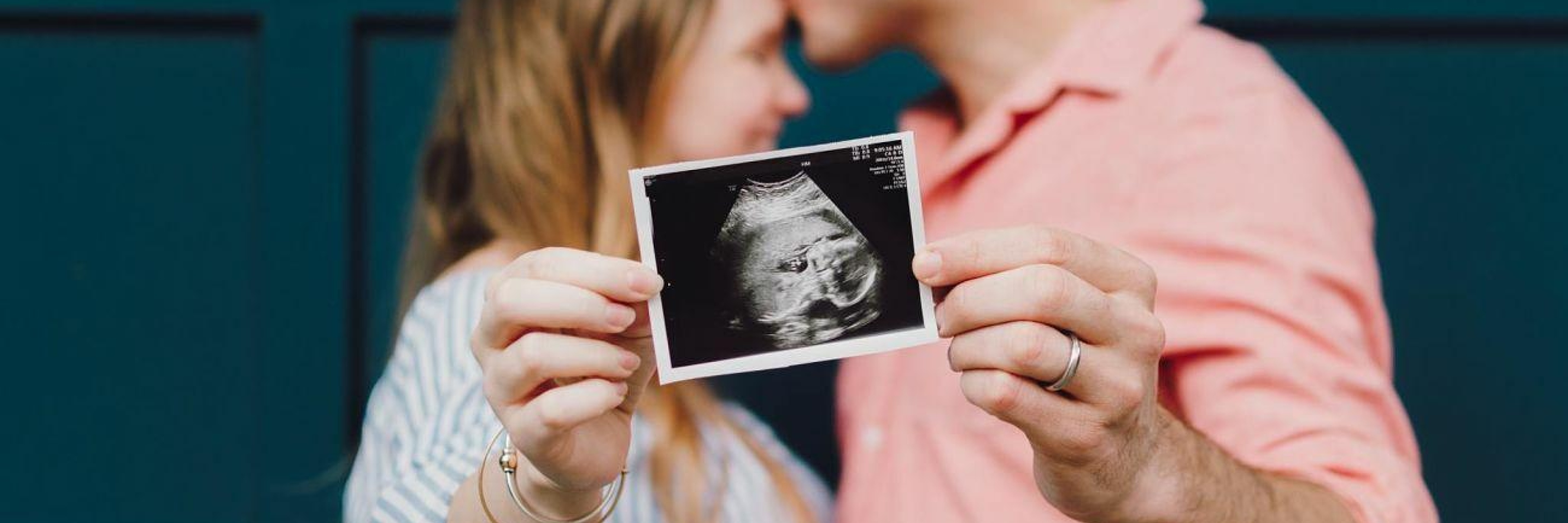 Baby scan